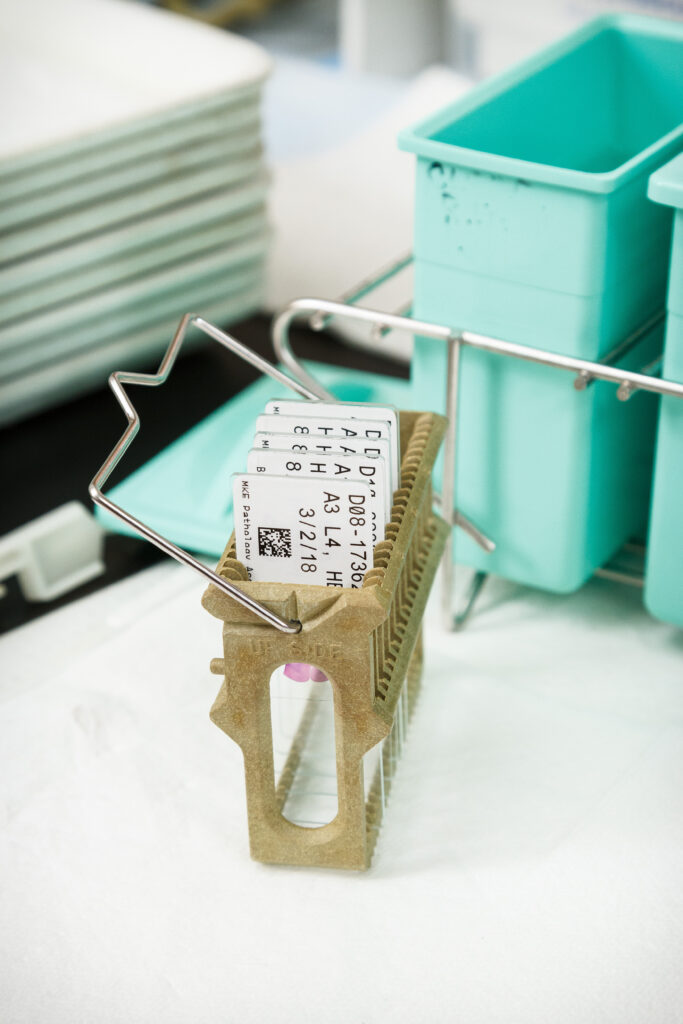 Podložní sklíčka označena štítkem